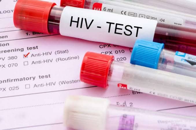 HIV